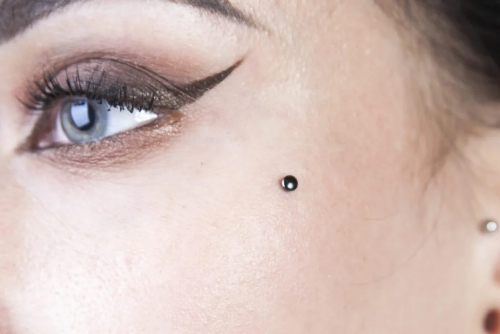 عوارض کاشت نگین در پوست؛ از عفونت تا مشکلات پوستی عوارض کاشت نگین در پوست؛ از عفونت تا مشکلات پوستی