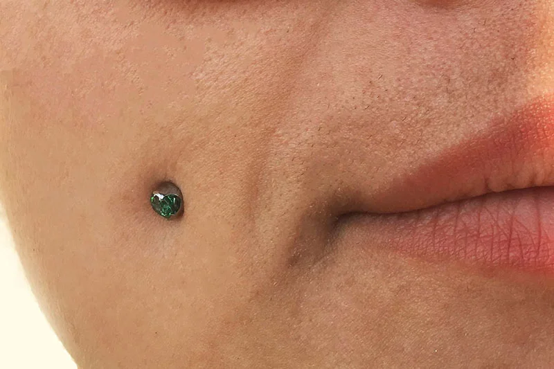 عوارض کاشت نگین در پوست؛ از عفونت تا مشکلات پوستی عوارض کاشت نگین در پوست؛ از عفونت تا مشکلات پوستی