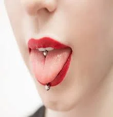 عوارض کاشت نگین در پوست؛ از عفونت تا مشکلات پوستی عوارض کاشت نگین در پوست؛ از عفونت تا مشکلات پوستی