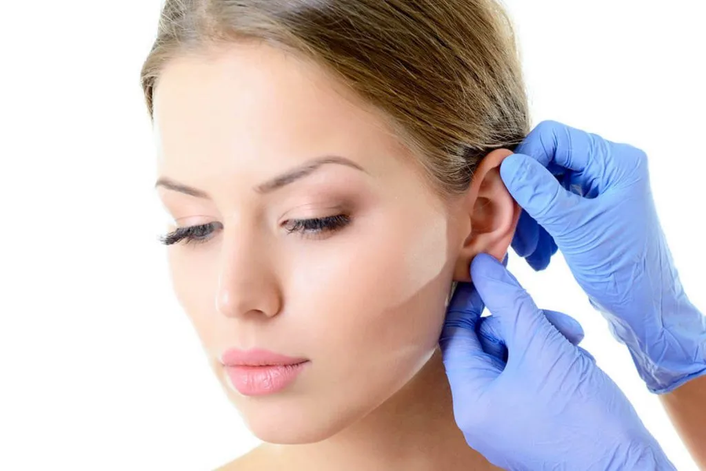 melinic otoplasty 1