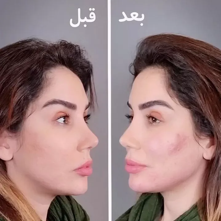 سازی فک و صورت مدلینگ jpg